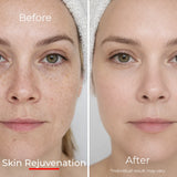 Sf GLow ® 4-in-1 Clinical LED Mask + LED Neck