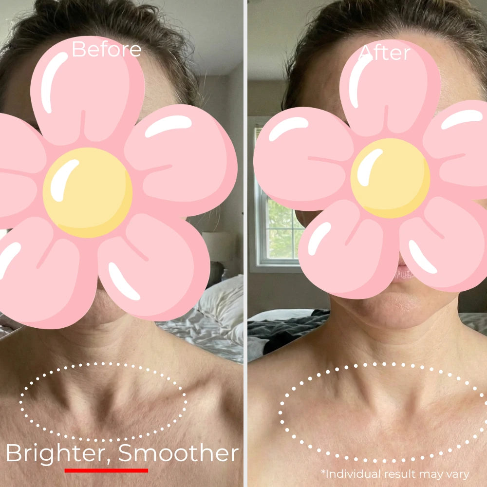 Sf GLow ® 4-in-1 Clinical LED Mask + LED Neck