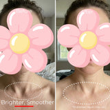 Sf GLow ® 4-in-1 Clinical LED Mask + LED Neck