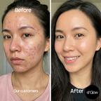 sf GLow ® 4-in-1 Clinical LED Mask