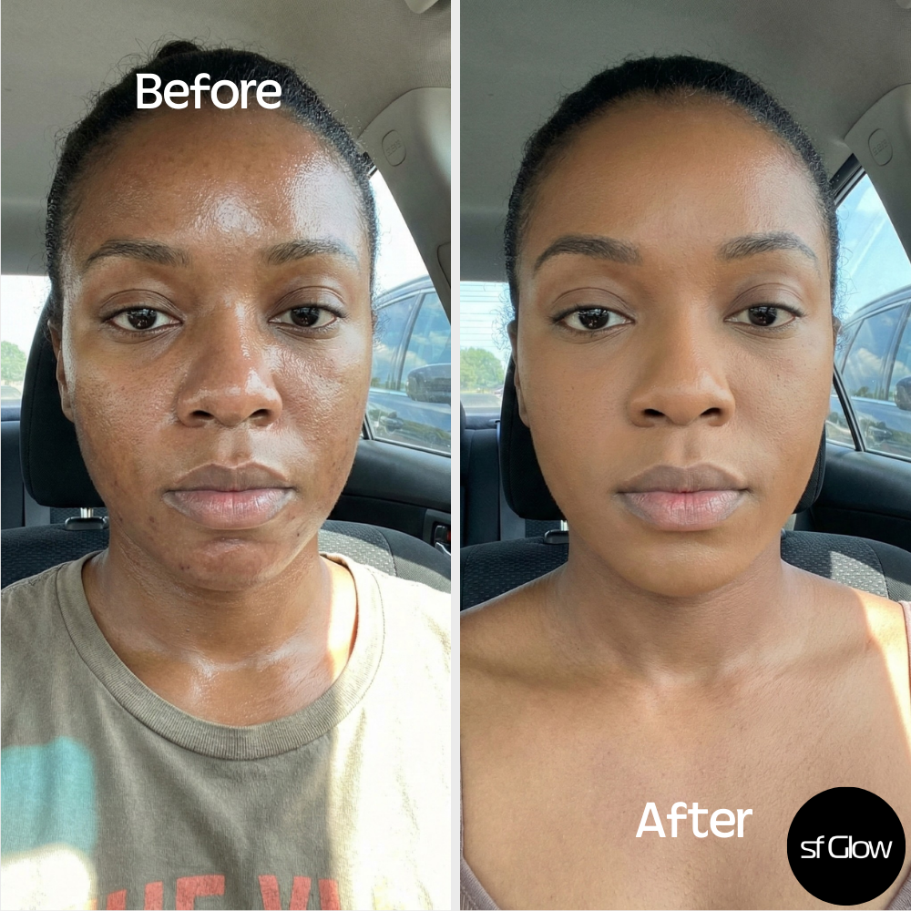 sf GLow ® 4-in-1 Clinical LED Mask + LED Neck