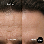 sf GLow ® 4-in-1 Clinical LED Mask