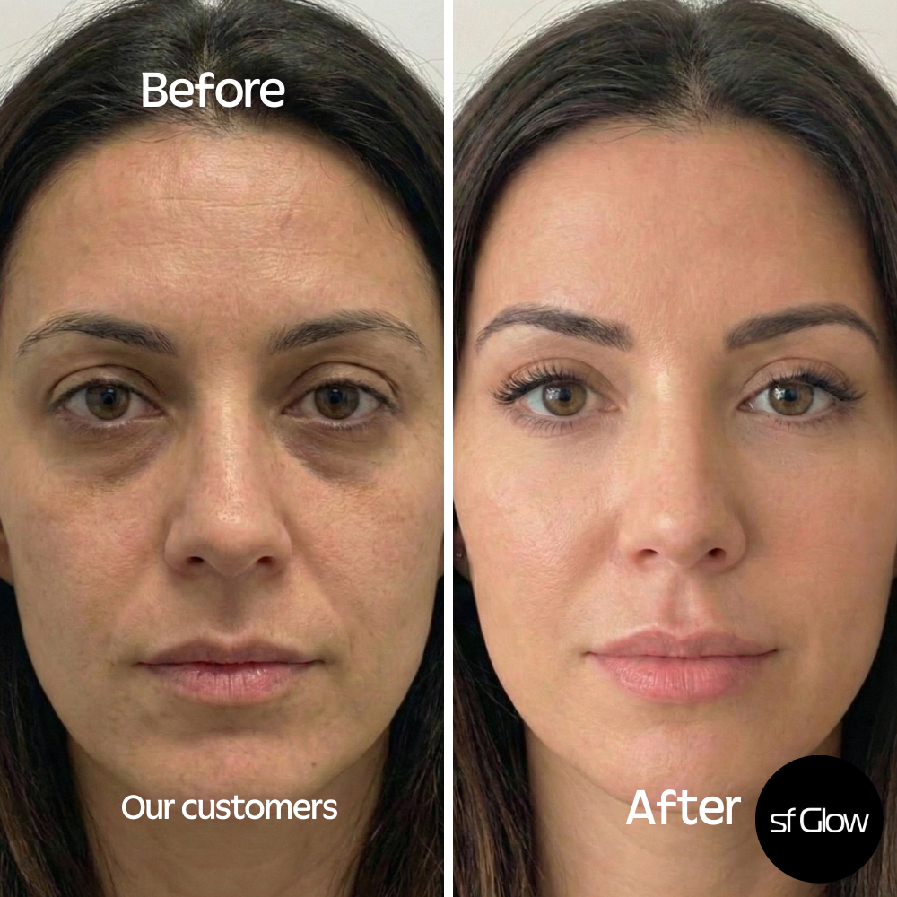 sf GLow ® 4-in-1 Clinical LED Mask