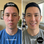 sf GLow ® 4-in-1 Clinical LED Mask