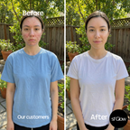 sf GLow ® 4-in-1 Clinical LED Mask