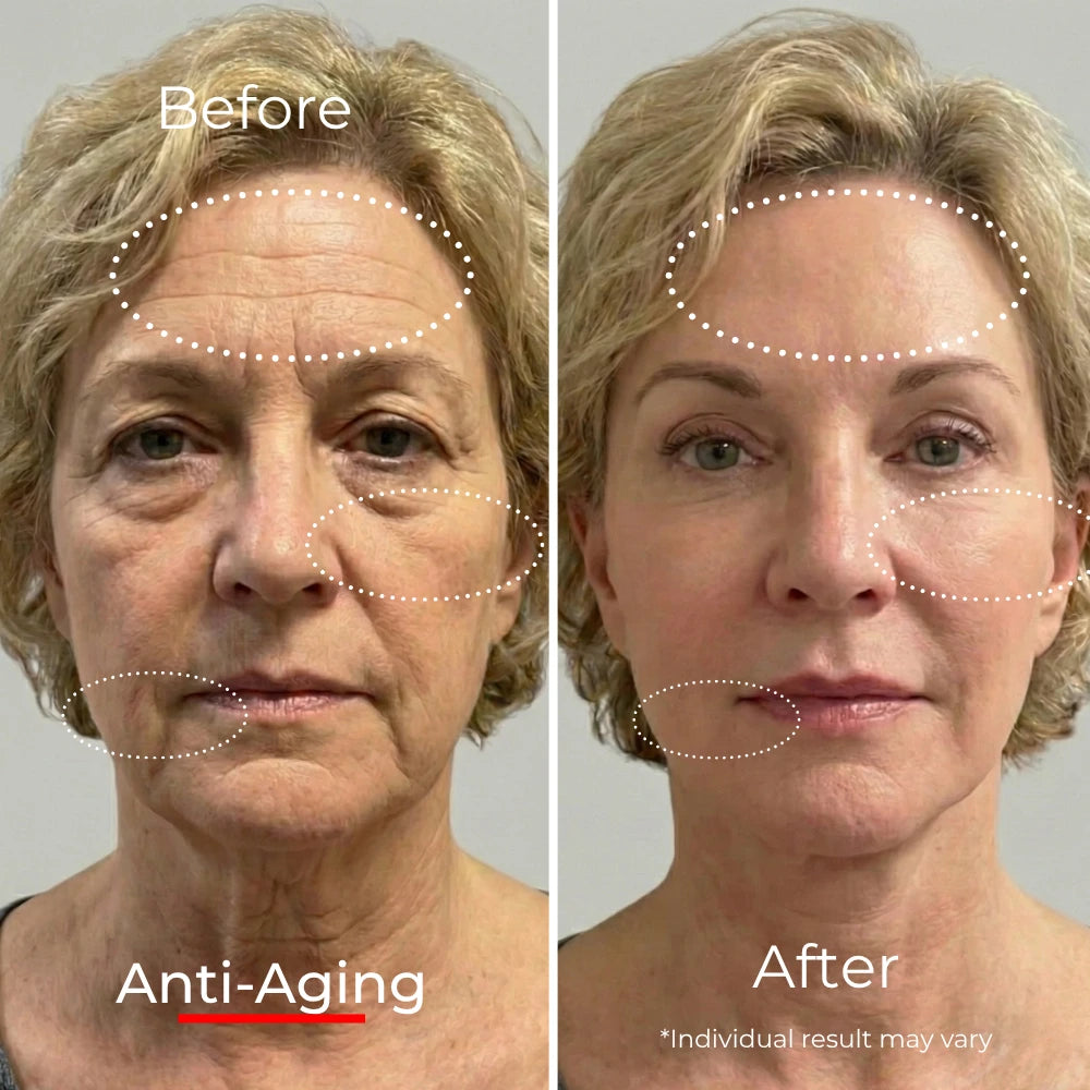 Sf GLow ® 4-in-1 Clinical LED Mask