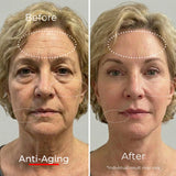 Sf GLow ® 4-in-1 Clinical LED Mask