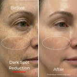 Sf GLow ® 4-in-1 Clinical LED Mask