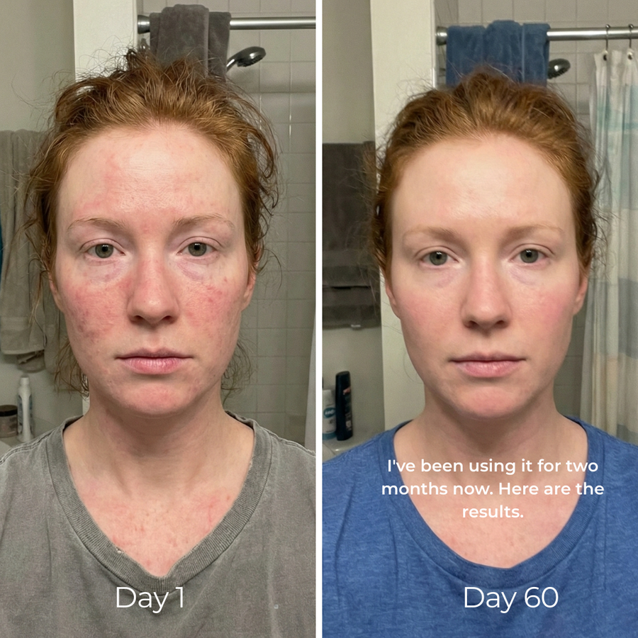 <p>Emily A, Mom of Two</p>