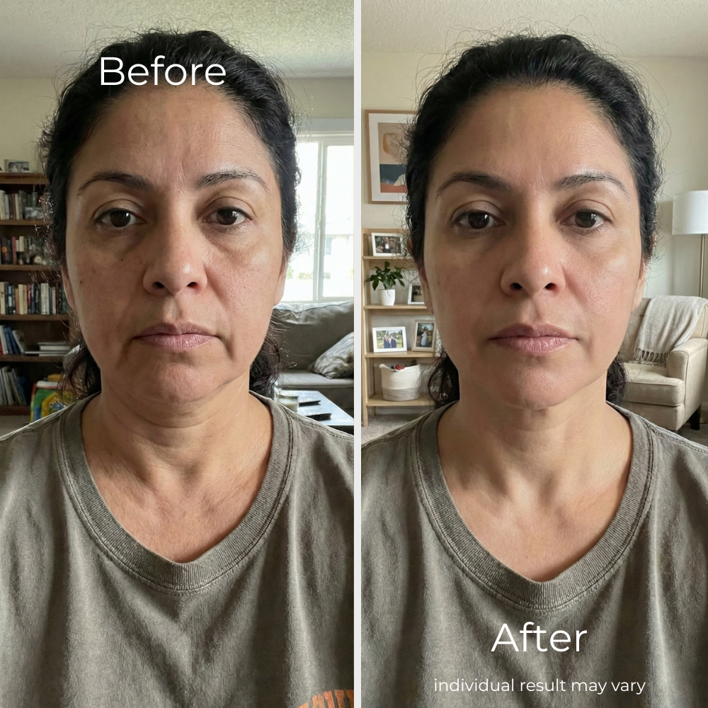 Sf GLow ® 4-in-1 Clinical LED Mask + LED Neck