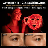 Sf GLow ® 4-in-1 Clinical LED Mask