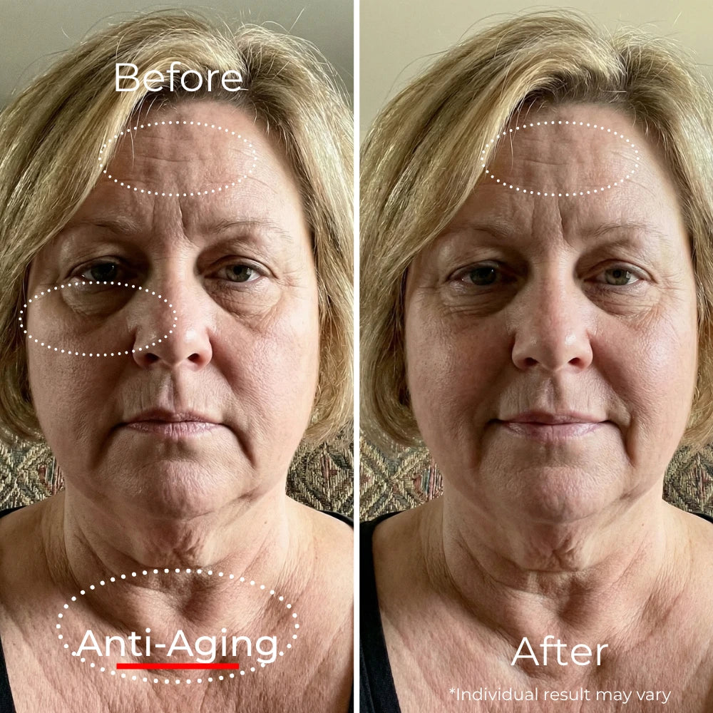 Sf GLow ® 4-in-1 Clinical LED Mask + LED Neck