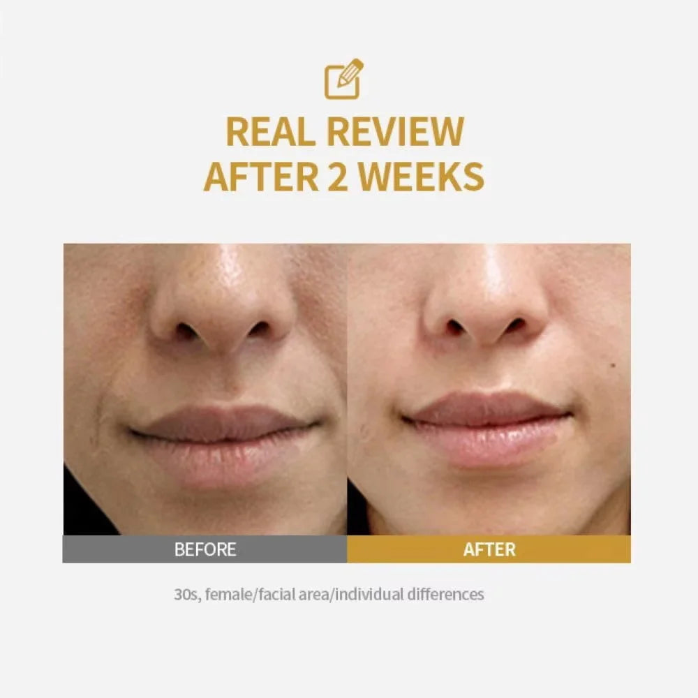 sf Glow® Clinical Finisher Syringe (Peptide & PDRN)